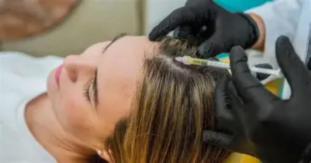 PRP Hair Restoration