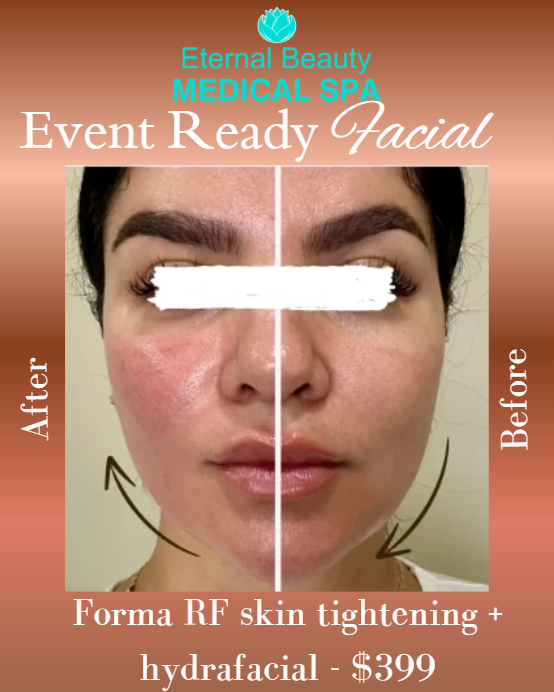 Event Ready Facial 